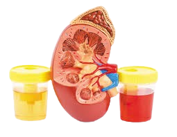 Chronic Kidney Disease