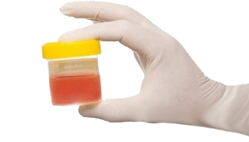 Chronic Kidney Disease