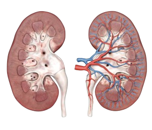 Diabetic Kidney Disease